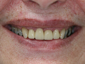 Person with aligned and white teeth